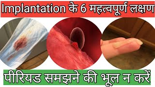 6 Successful implantation symptomsimplantation के 6 लक्षण। [upl. by Abigale]