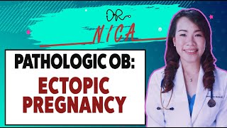 Lectures  Pathologic OB  Ectopic Pregnancy [upl. by Letizia]