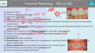 Indications and Contraindications for Coronal Polishing StudentRDH [upl. by Toll]