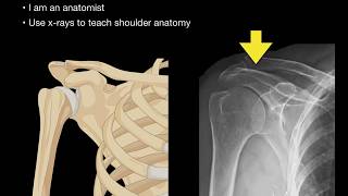 Knee Arthroscopy Animated Video [upl. by Newmann]