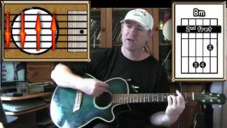 Comfortably Numb  Pink Floyd  Acoustic Guitar Lesson [upl. by Asiat]